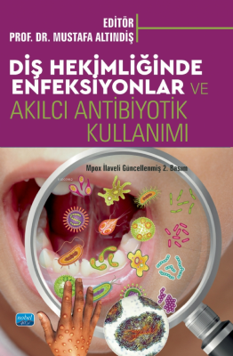 Diş Hekimliği Enfeksiyonları ;Akılcı Antibiyotik Kullanımı Mustafa Alt